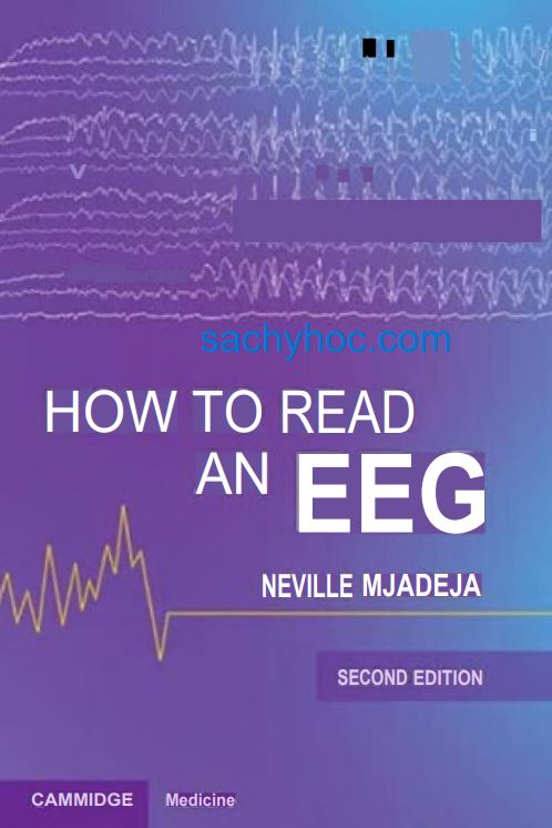 Cách Đọc Điện Não Đồ (EEG), Ấn bản thứ 2 (2025) Cách Đọc Điện Não Đồ (EEG), Ấn bản thứ 2 (2025)